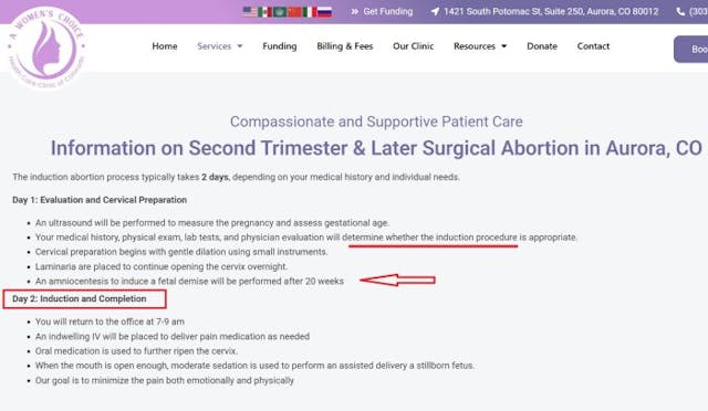 Women’s Choice induction abortion later in pregnancy Women's Choice induction abortion later in pregnancy
