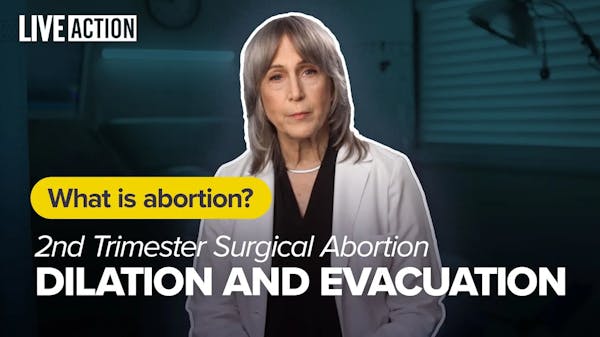 2nd Trimester D&E Abortion 2nd Trimester Abortion