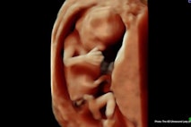 15 wks 4 days (2) – 4D Ultrasound Lady