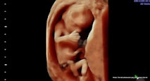 15 wks 4 days (2) – 4D Ultrasound Lady