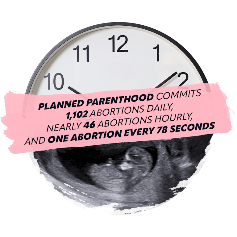 A clock and a sonogram