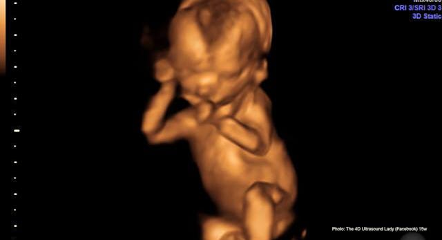 Doctors pressured pregnant mom with cancer to abort, despite what research reveals image