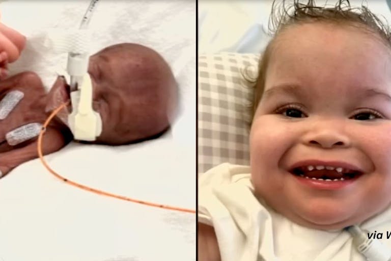 Baby Kingston (Screenshot via WDRB) preemie baby Kingston