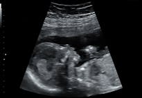 ultrasound of baby at 16 weeks