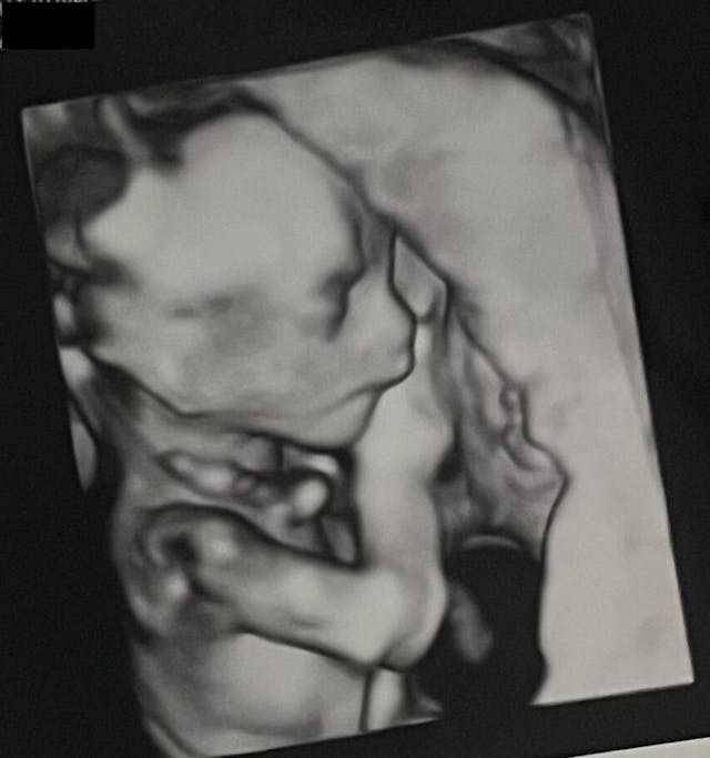Baby Evans 3D Ultrasound 16w 2d (Photo: Savannah Evans) 3D ultrasound of baby at 16 weeks
