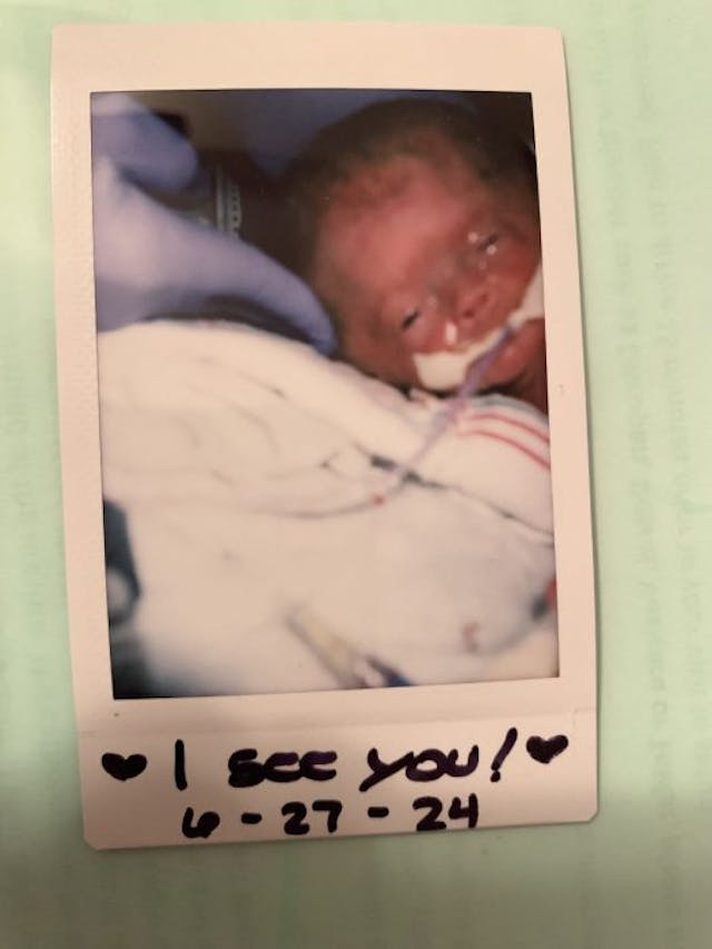 Baby Laurel Rose is born (Photo courtesy of the Nielsen family) Family learns ‘God has the final say’ after difficult prenatal diagnosis image