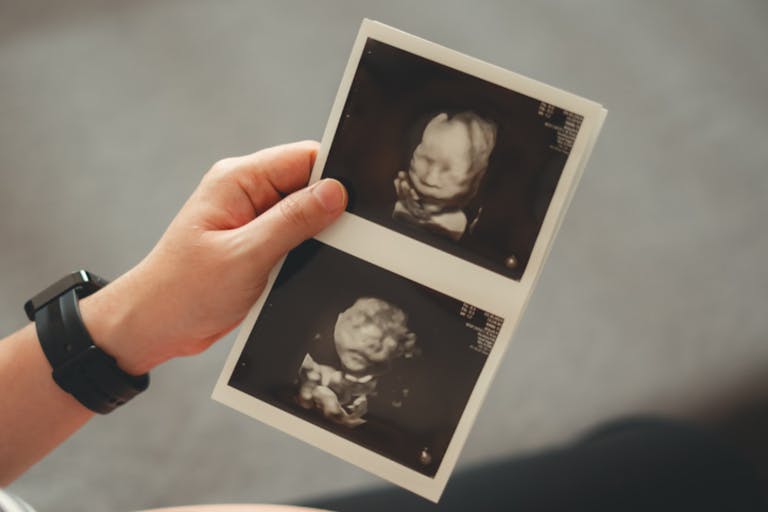 Photo: Jajah-sireenut/Getty Images Close-up shot of pregnant woman holding and looking at ultrasound scans, sitting on sofa in living room at home.