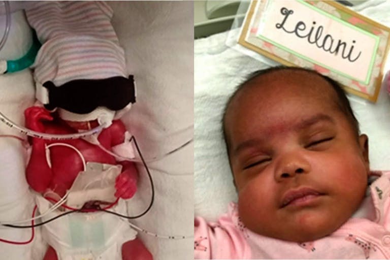 Screenshots: WTVR News 6 micro-preemie Leilani