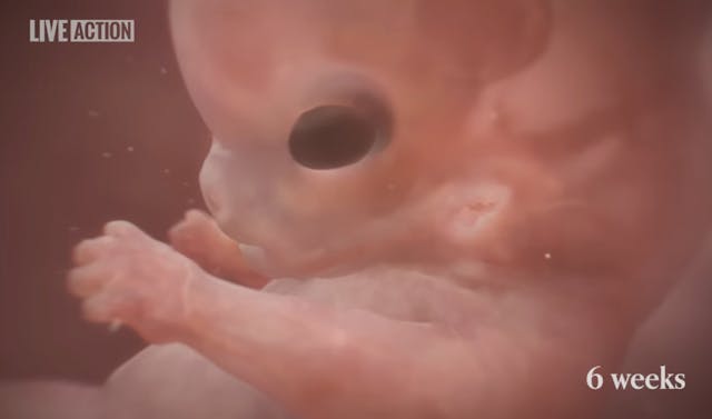 Screenshot: Baby Olivia 6 weeks post-fertilization Image of Baby Olivia computer animation at 6 weeks post-fertilization