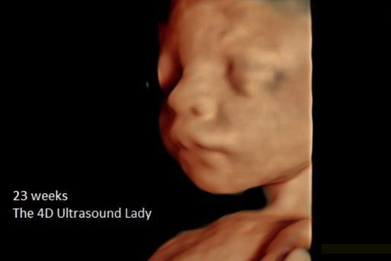 Photo: The 4D Ultrasound Lady (Facebook) - 23 weeks Ultrasound of preborn baby at 23 weeks gestation