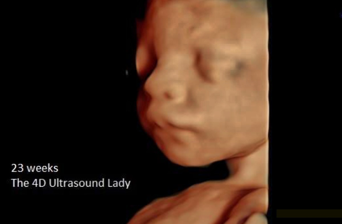 Disturbing Oregon data shows increase in later abortions and abortion tourism | Live Action