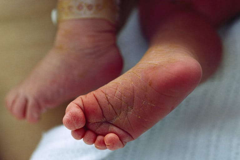Photo: Jason Edwards/National Geographic Society via Getty Images A newborn baby's soft and wrinkled feet.