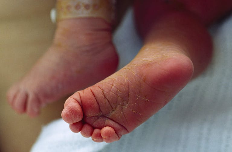 A newborn baby's soft and wrinkled feet.