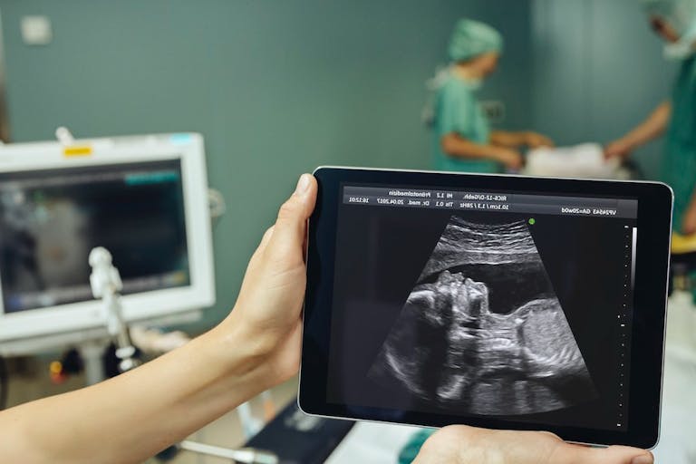 fetal surgery, fetal pain