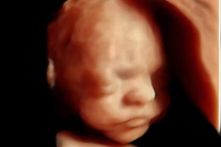 Photo: 24 weeks gestation/4D Ultrasound Lady (Facebook) 24 wks gestation – 4D Ultrasound Lady