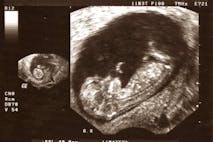 Ultrasound female week 11