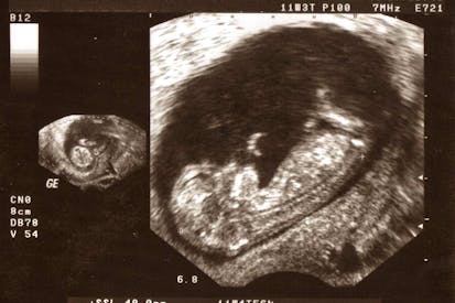 Ultrasound female week 11