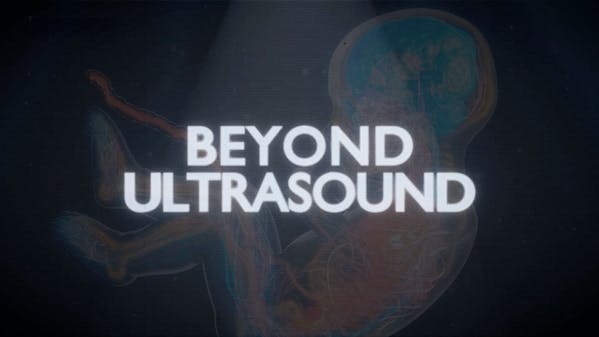 Beyond Ultrasound