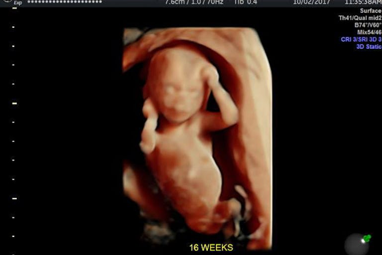 Photo: 4D Ultrasound Lady (Facebook) - 16 weeks gestation preborn baby 16 weeks