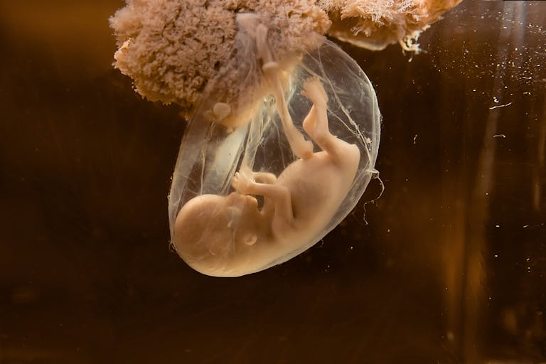 Photo: Shutterstock A human embryo, gestation unknown