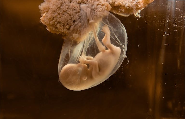 human embryo, unknown gestation