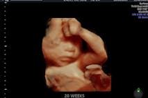 Photo: 4D Ultrasound Lady (Facebook) 20 weeks prolife, miracle, fetus, unborn child, TED