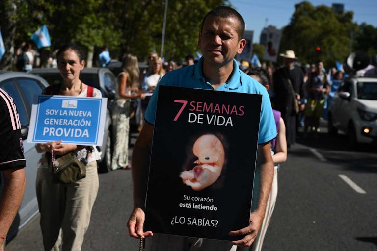 Photo: LUIS ROBAYO/AFP via Getty Images Demonstrators hold signs depicting pro-life options during an anti-abortion march in the 10th edition of the "March for Life" in Buenos Aires on March 29, 2025. (Photo by Luis ROBAYO / AFP)