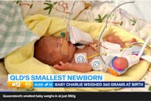 Baby Charlie in his hospital bed shortly after his birth.