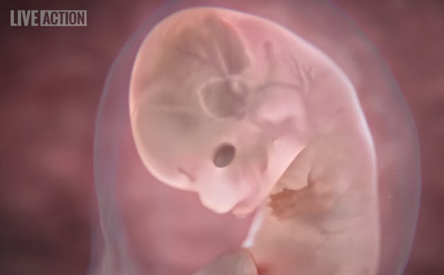 Photo: Baby Oliver (approx. 8 weeks post-fertilization) - Live Action Baby Oliver approximately 8 wks post-fertilization