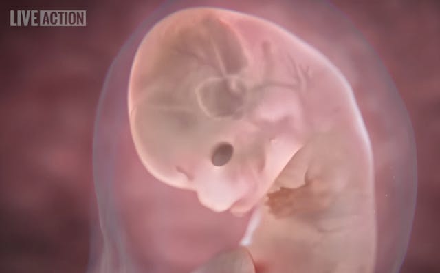 Baby Oliver approximately 8 wks post-fertilization