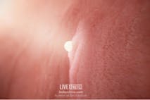 Implantation (one week after fertilization)