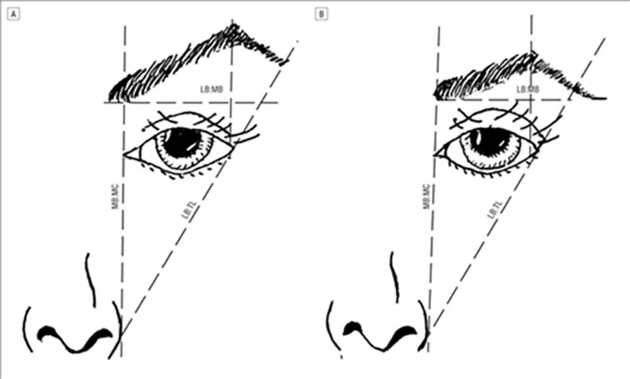 face illustration