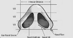 Alar Base glossary Chicago