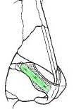 Lower lateral cartilages glossary