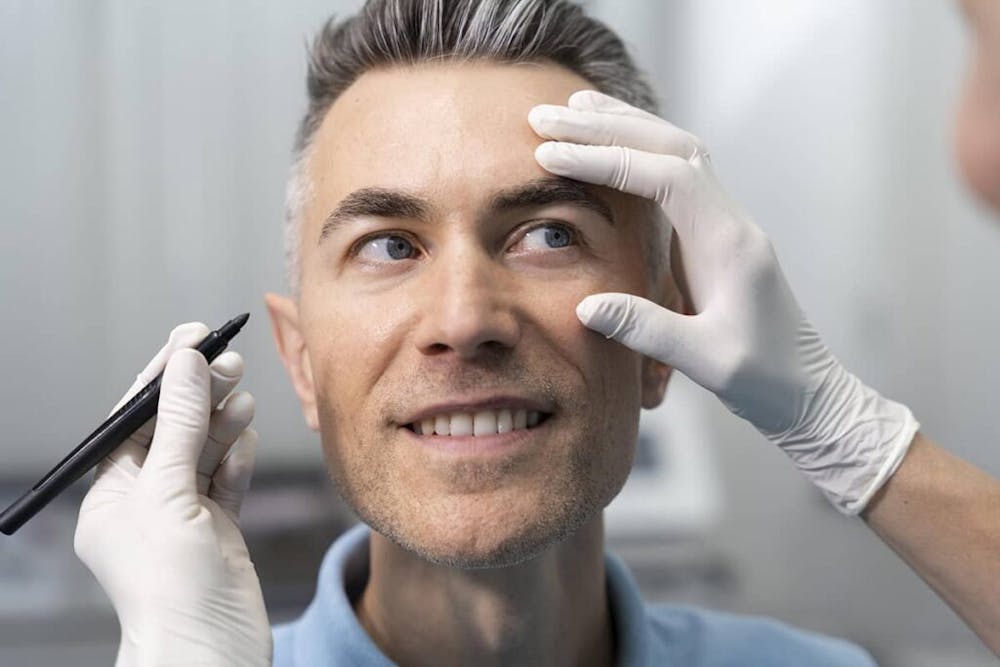 Lower blepharoplasty can produce lasting results, with effects often noticeable up to 10 years after the procedure