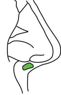 Plumping Graft