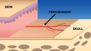 Septal Perforation Pericranium
