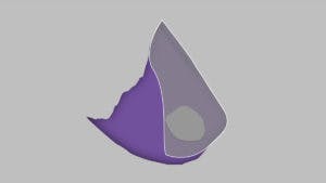 Septal Perforation Dead Skin