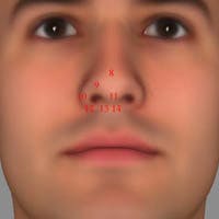 Nasal Base Anatomy Nasal Base Anatomy
