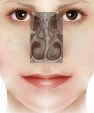 Crooked nose deformity 1
