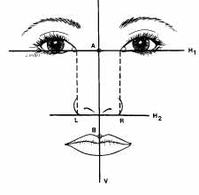 Guyuron Analysis