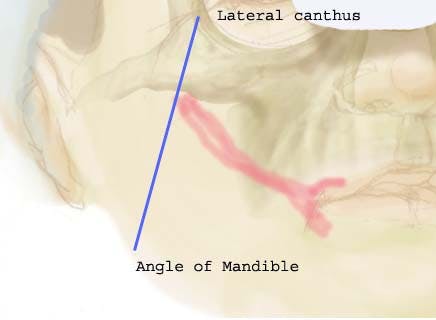 Tramoloda Method of Identifying ZM