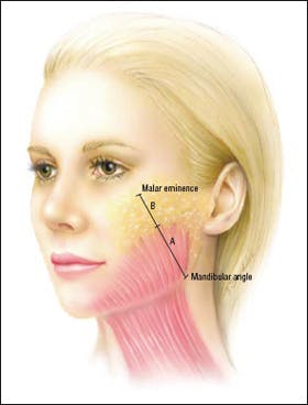 Artist's depiction shows the measurements