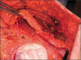 Operative photograph