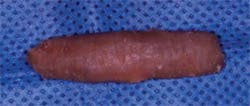 Concentric and Eccentric Carved - Figure 1