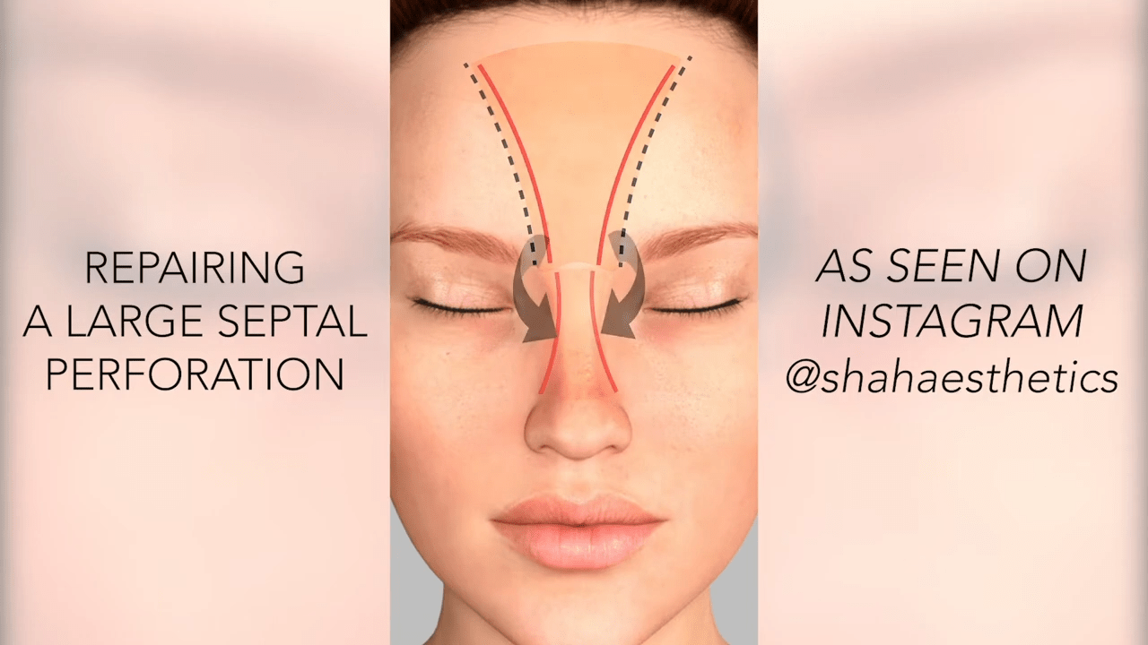 Diagram of person's face