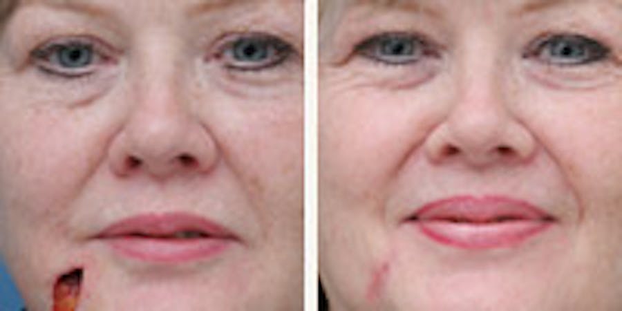 Before and after photos of patient