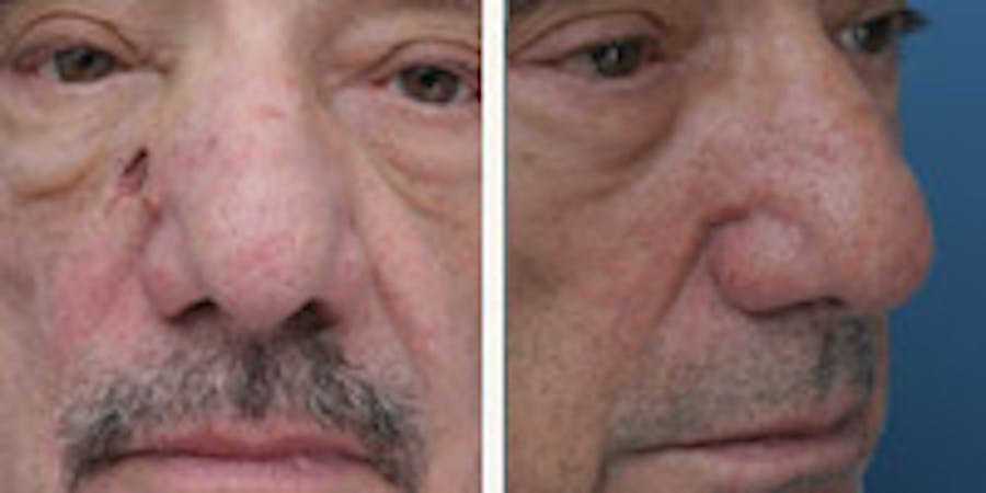 Before and after photos of patient