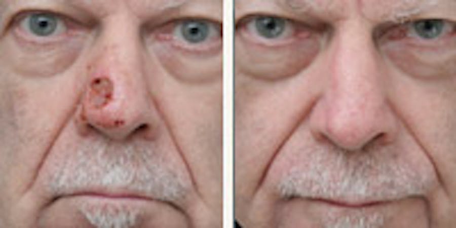 Before and after photos of patient