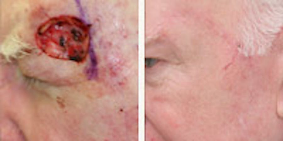 Before and after photos of patient